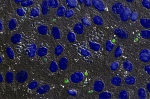 Imagen obtenida por microscopía de fluorescencia, correspondiente a células de ratón infectadas con Trypanosoma cruzi. En azul se observa el DNA de las células de mamífero y del parásito mientras que en verde se detectan los parásitos transgénicos que sobreexpresan la metacaspasa-3 activa. Nótese que aquellos parásitos que no sobreexpresan la metacaspasa-3 (flecha negra) son capaces de multiplicarse dentro de la célula de mamífero, mientras que aquellos parásitos que lo hacen (flecha blanca) se multiplican en mucho menor medida. Créditos: Lic. Marc Laverriere