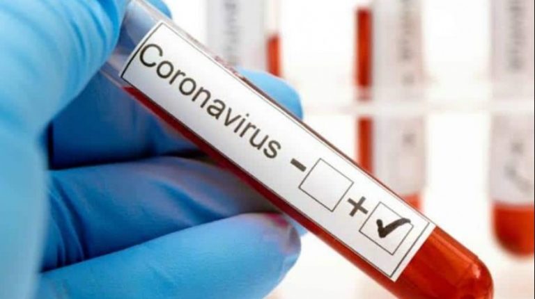 ULTIMO MOMENTO: Confirman un nuevo infectado por COVID-19