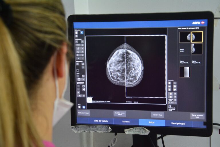 Prevención del Cáncer de Mama: actividades y mamografías