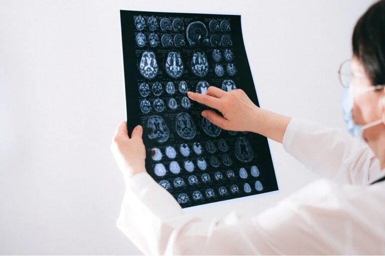 Día Mundial del Cerebro: señales para detectar un ACV